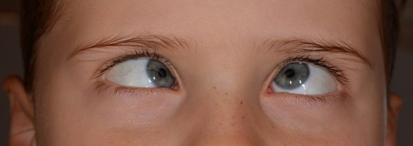 děti, oči, oční vady, rodiče, oční lékař