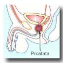 Prostata