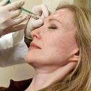 Botox: omládnete jako mávnutím kouzelného proutku!